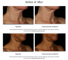 Load image into Gallery viewer, Neck Correct Cream