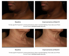 Load image into Gallery viewer, Neck Correct Cream