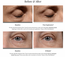 Load image into Gallery viewer, Instant Bright Eye Cream